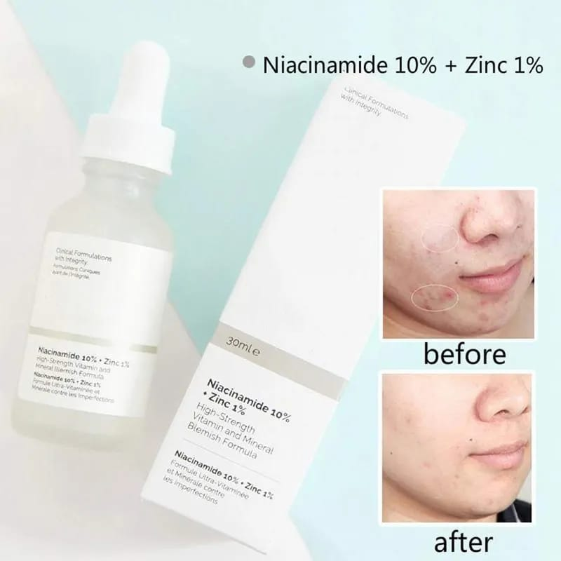 Serum facial Niacinamida Ordinary