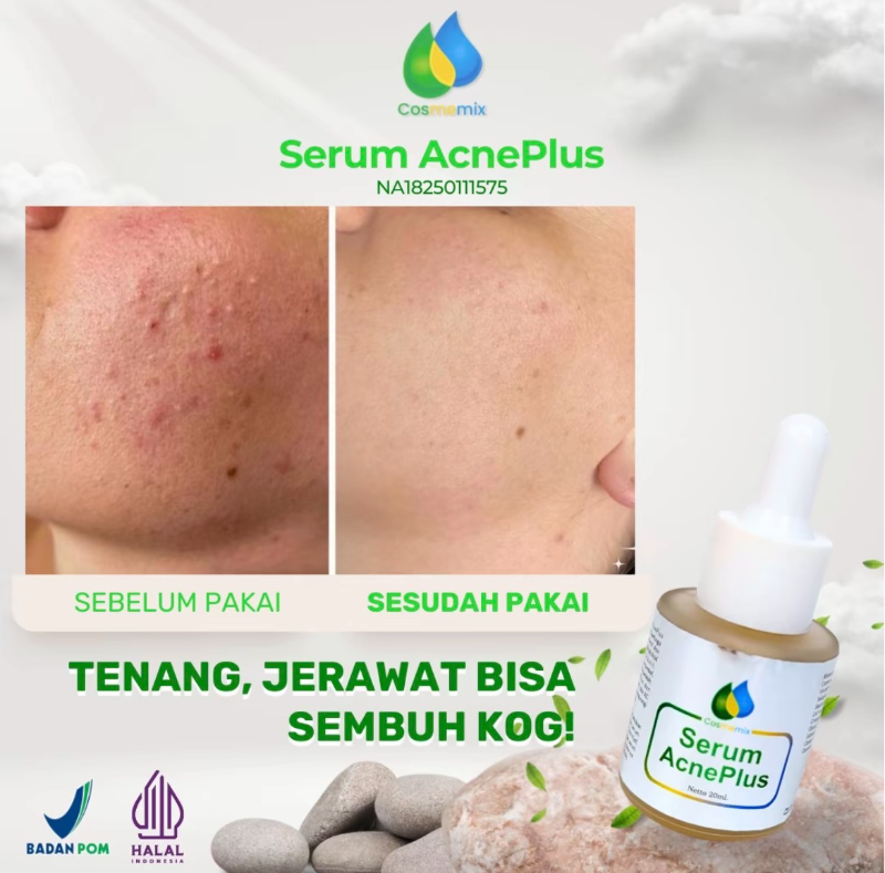 Serum Acne Plus