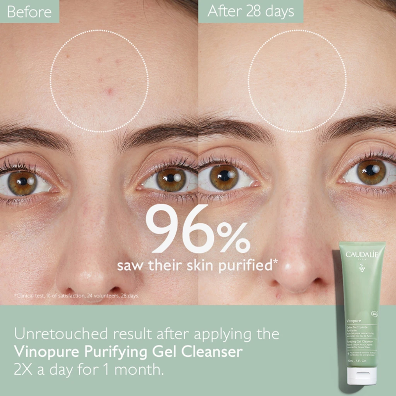 CAUDALIE VINOPURE PURIFYING GEL CLEANSER - 150 ML