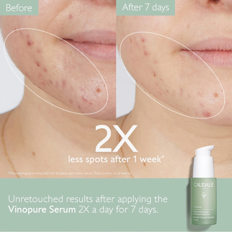 CAUDALIE VINOPURE BLEMISH CONTROL SALICYLIC SERUM - 30 ML