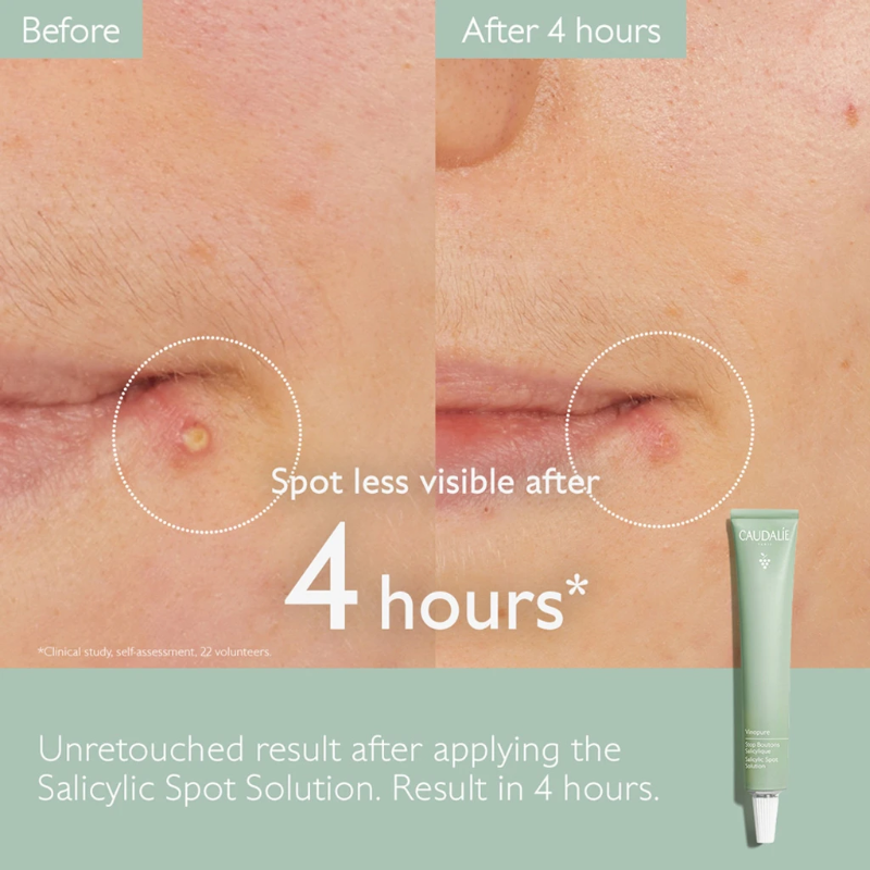 CAUDALIE VINOPURE SALICYLIC SPOT SOLUTION - 15 ML