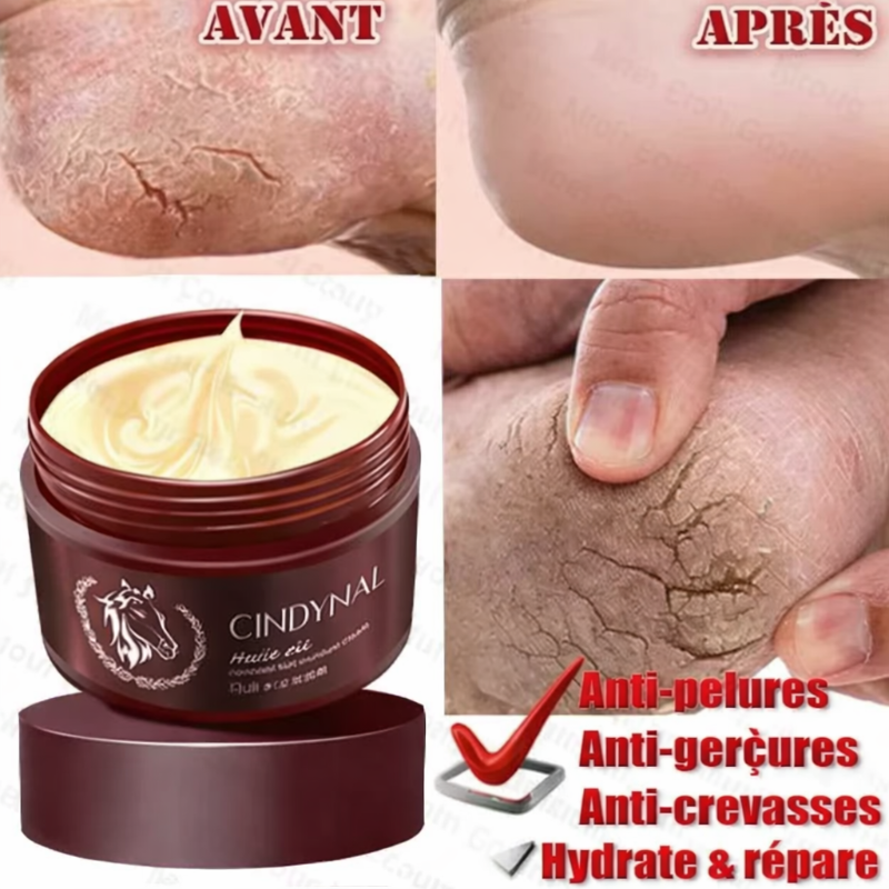 Crème hydratante et confortable pour les mains, les pieds et les talons secs