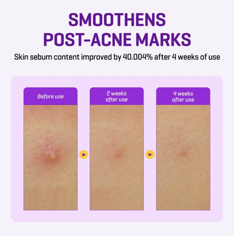 Some By Mi RETINOL INTENSE Reactivating Serum