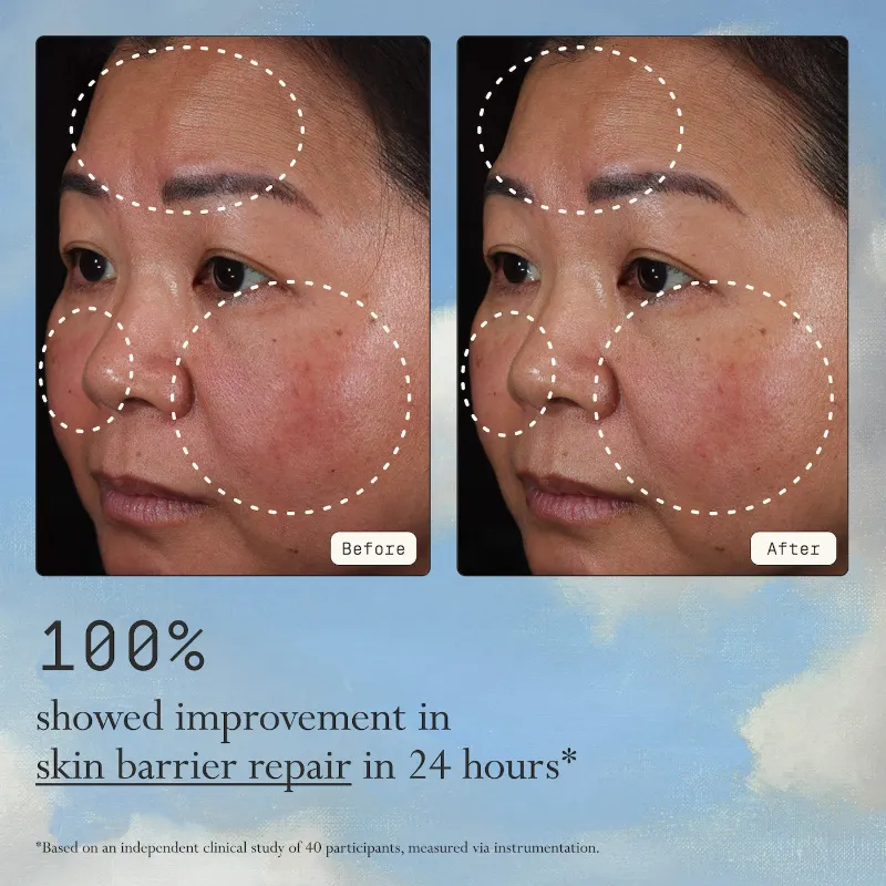 Dieux Mini Instant Angel Lipid & Peptide-Rich Moisturizer + Barrier Repair