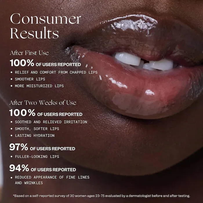 VIOLETTE_FR 
BALM AMOUR Nourishing Lip Treatment with Peptides