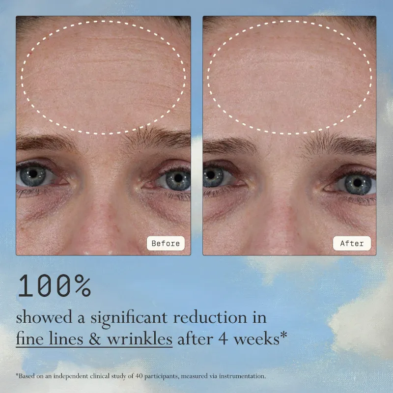 Dieux Mini Instant Angel Lipid & Peptide-Rich Moisturizer + Barrier Repair