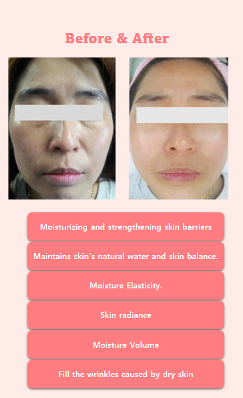 CIESKIN RED VOLUME ESSENCE (30ml)

CIESKIN 红颜精华 (30ml)