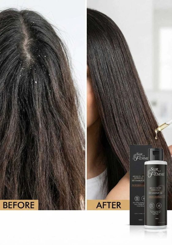 Sur La Femme - Anti Dandruff Oil (100 Ml)