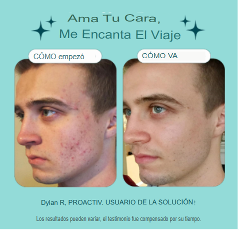 Proactiv Tratamiento para el acné de 3 pasos con parches de espinillas, lavado facial de peróxido de benzoílo, tratamiento reparador de manchas de acné para cara y cuerpo, tónico exfoliante, kit