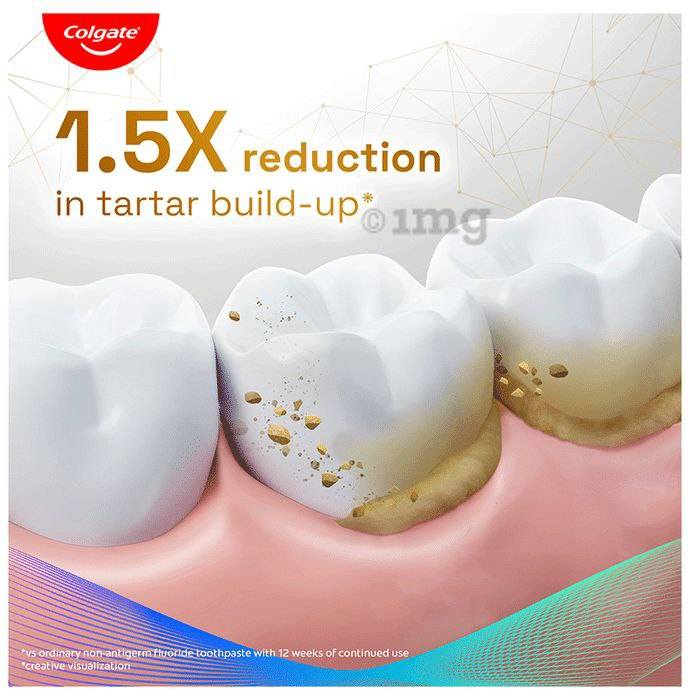 Colgate Total Anti-Tartar 150gm