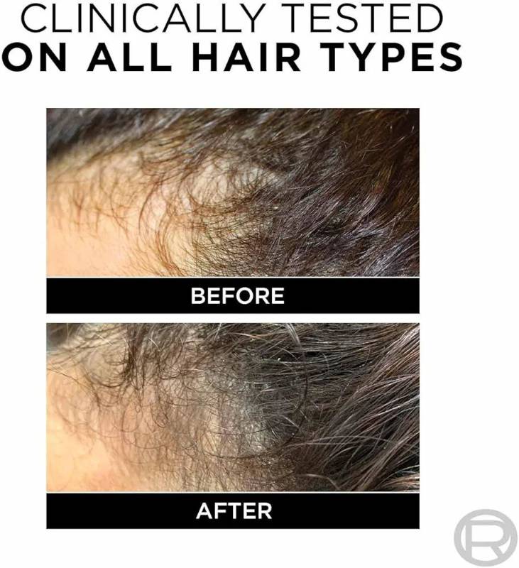 Loreal Fall Resist Shampoo Anti Hair Fall 340ml