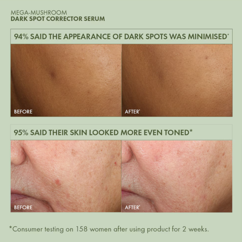Dr. Andrew Weil for Origins™
Mega-Mushroom Dark Spot Corrector Serum