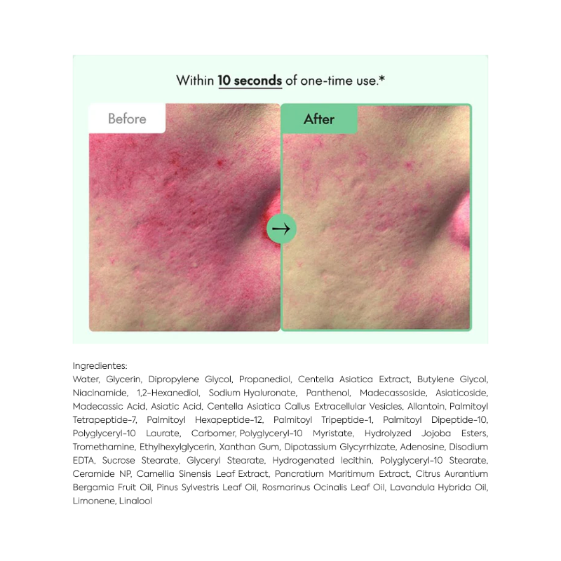 Wonder Releaf
Centella Serum