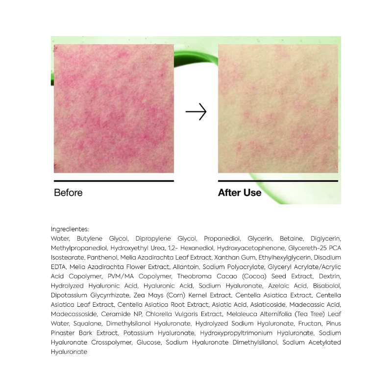 Azelaic Acid 10 Hyaluron Redness Soothing Pad