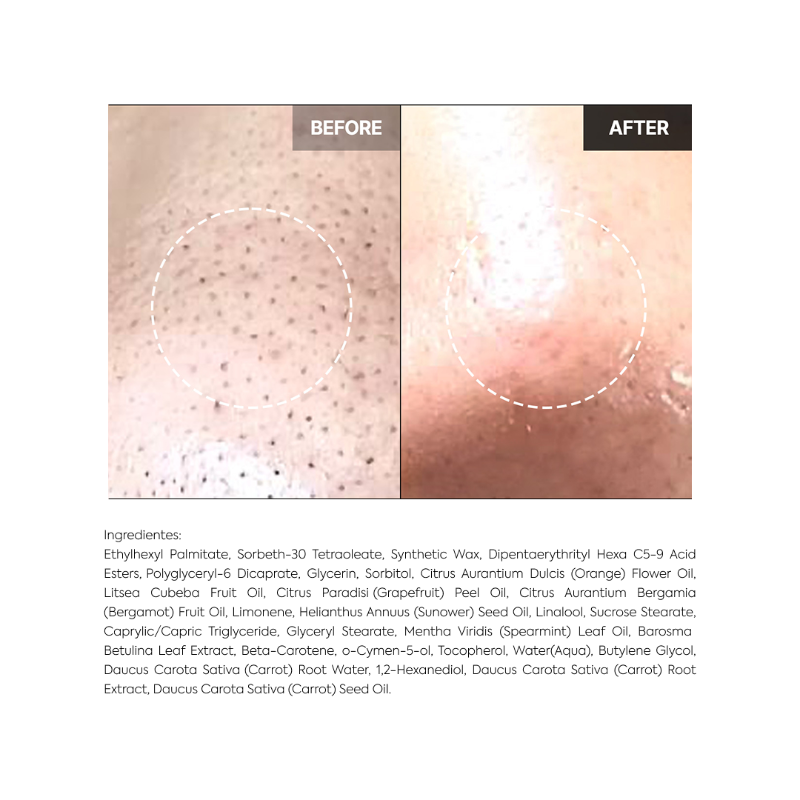 Carrotene IPMP
Hydramelt Cleansing Balm