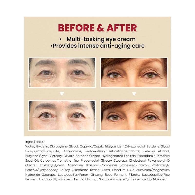 SEOUL 1988
Eye Cream Retinal Liposome
4% + Fermented Bean