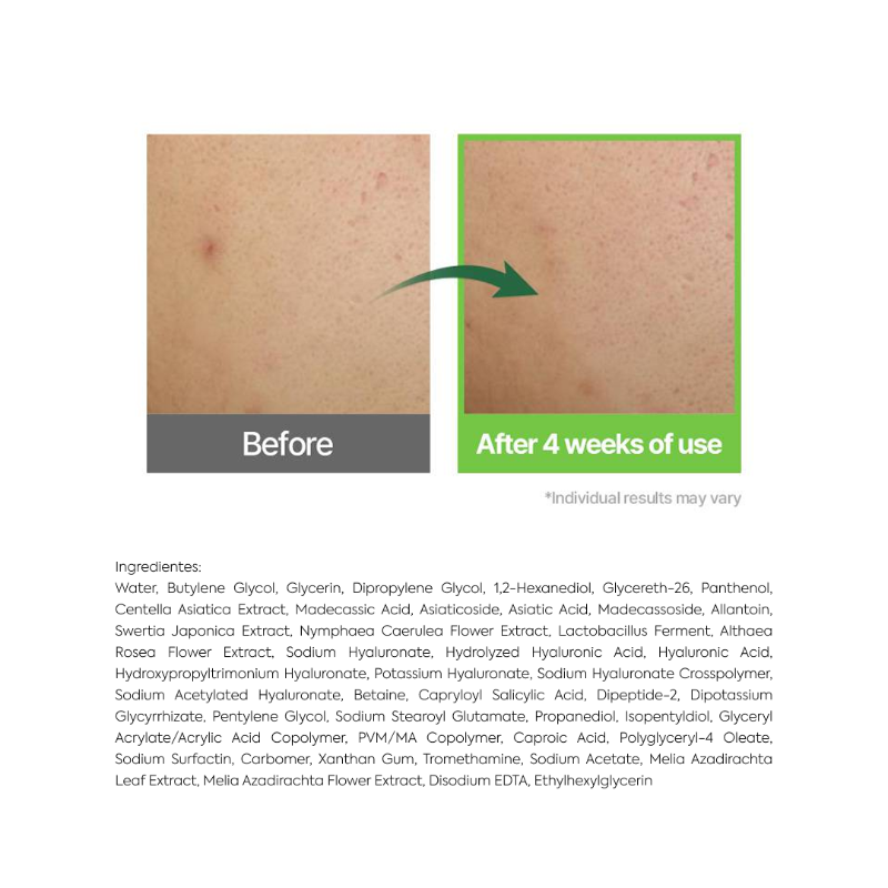 Balanceful Cica
Serum