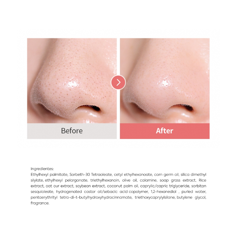 Calamine Pore Control Cleansing Oil
