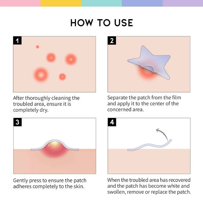 Star Spot Acne Pimple Patch