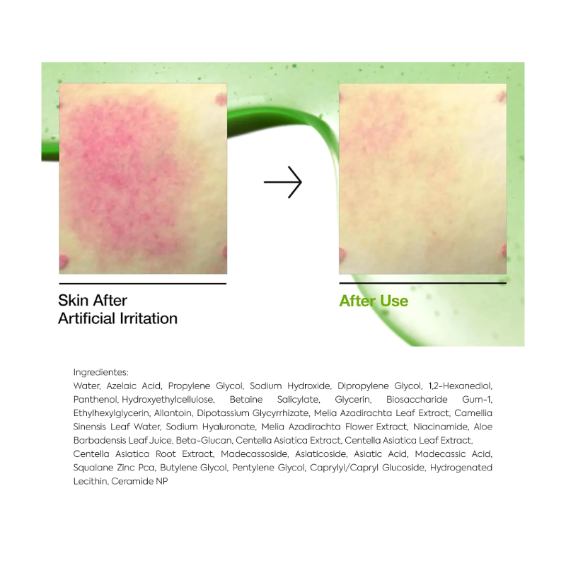 Azelaic Acid 10 Hyaluron
Redness Soothing Serum