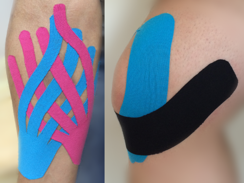 Dyna Kinesiology Therapeutic Tape