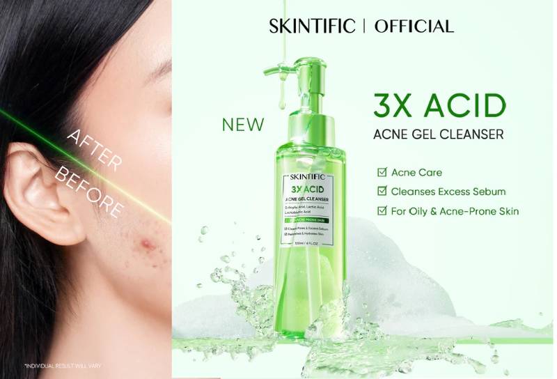 S129 3x Acid Acne Cleanser 1/8/9/120ml | 810114871799