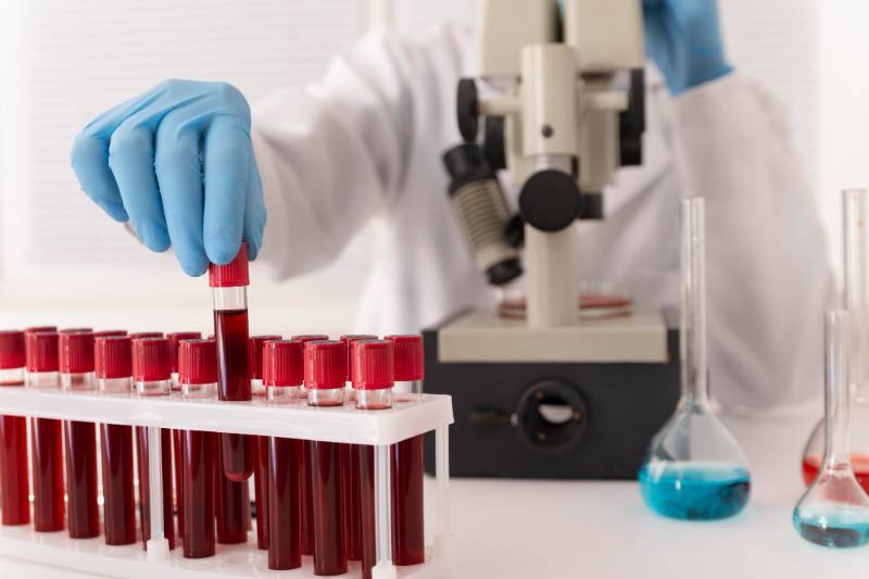 Complete Blood Count(CBC)