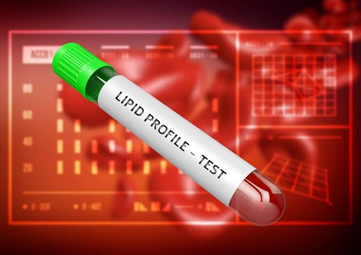 Lipid (Cholesterol) Profile