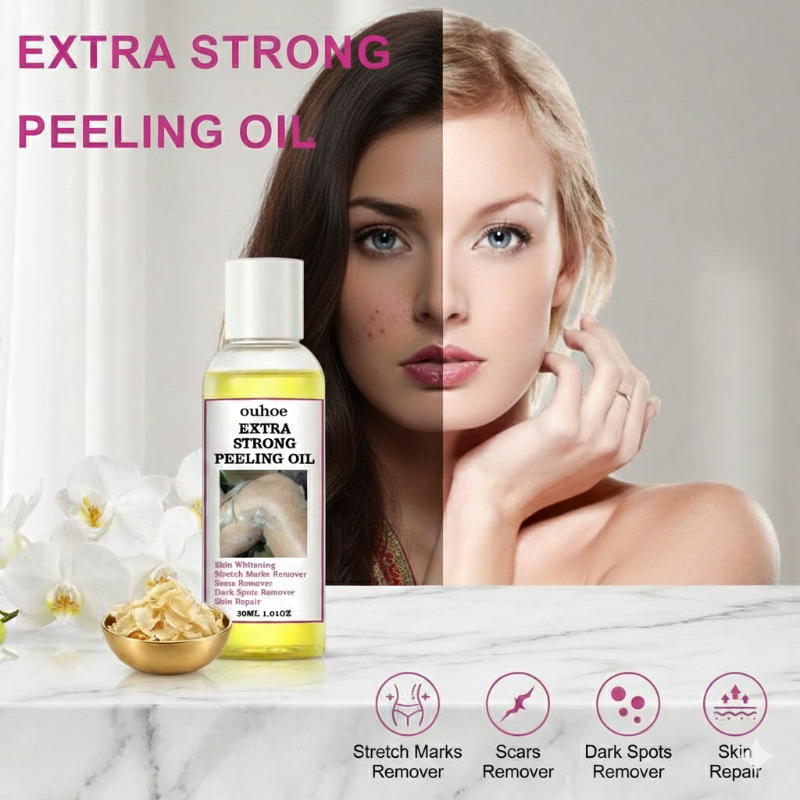 زيت التقشير فائق القوة من أوهو - تقشير كيميائي منزلي لتفتيح اسمرار الكوعين والركبتين وعلامات التمدد  Ouhoe Extra Strength Peeling Oil - At-Home Chemical Peel for Dark Elbows, Knees, and Stretch Marks 30ml