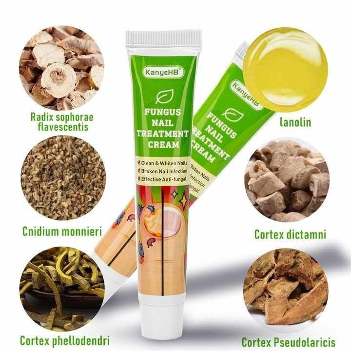 Crème de Traitement Antifongique pour les Ongles des Pieds