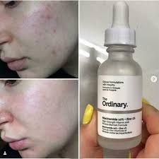 The Ordinary Niacinamide 10%