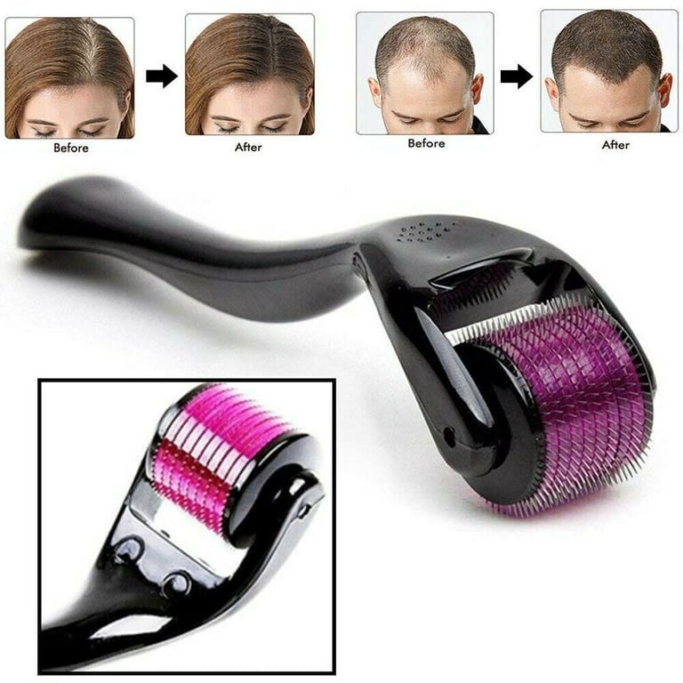 Derma Roller, 0.5mm for Hair and Skin Therap