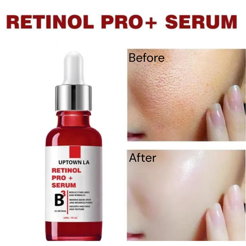 UPTOWN LA Retinol PRO+ Serum - Fine Lines, Dark Spots & Pore Minimizer
