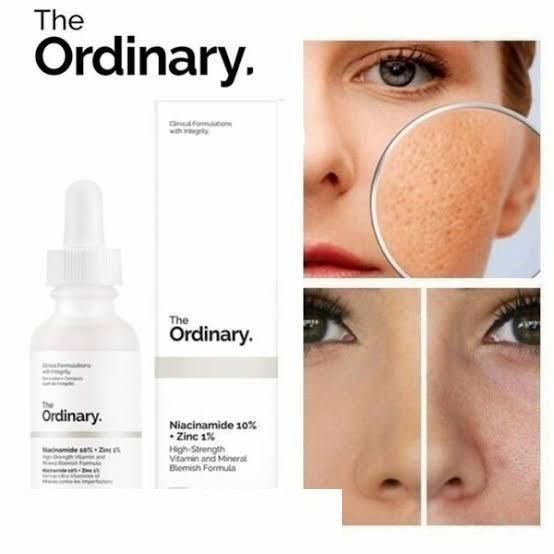 The Ordinary: Niacinamide 10% + Zinc 1% for Blemishes and Pores