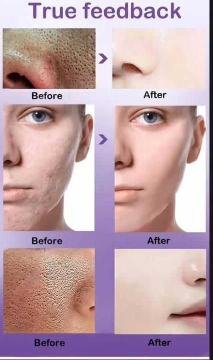 Dark Spots Removal Face Serum