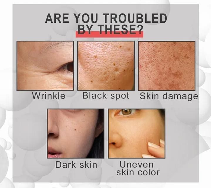 UPTOWN LA Retinol PRO+ Serum - Fine Lines, Dark Spots & Pore Minimizer