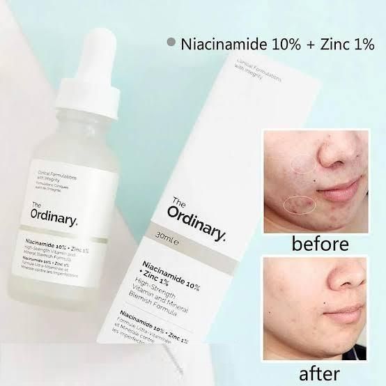 The Ordinary: Niacinamide 10% + Zinc 1% for Blemishes and Pores