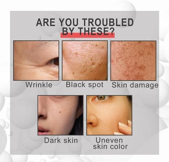 Blemish Removal Retinol Serum