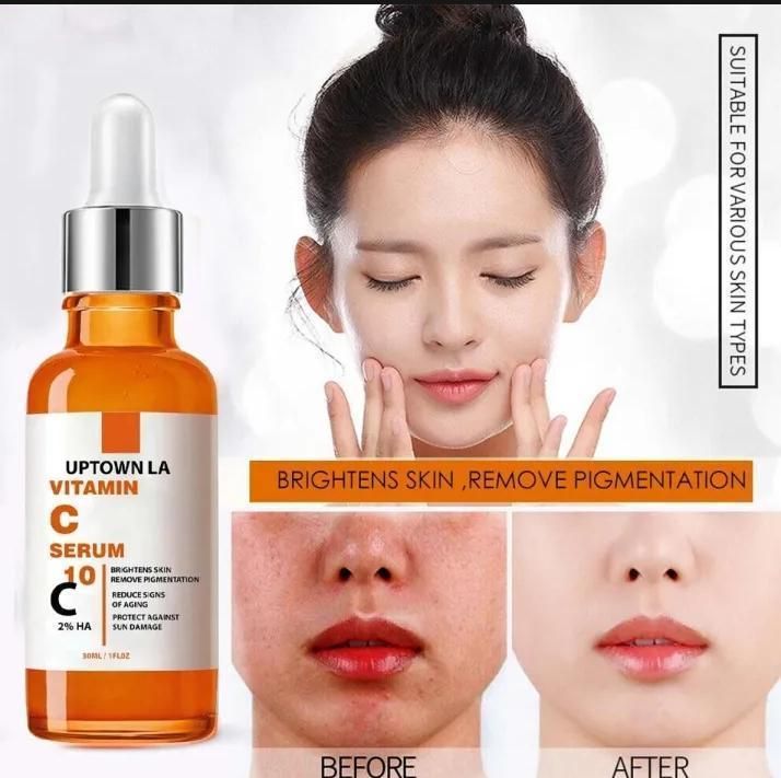 Uptown LA Vitamin C Brightening Serum for Face | Anti-Aging, Fades Dark Spots, Pigmentation & Dullness