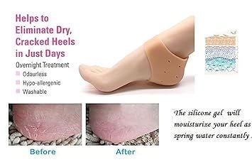 Zuha  Silicone Gel Heel Pad Socks for Pain Relief - 1 Pair (Beige, Free Size)