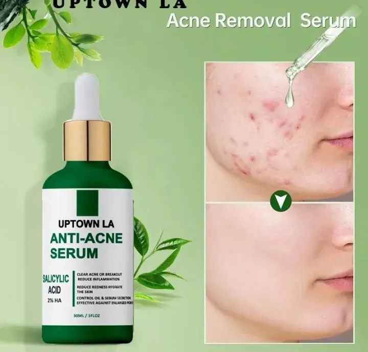 uptown la Anti Acne Face Serum