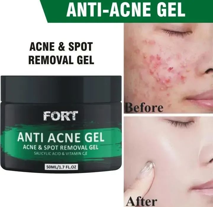 Uptown La Acne Scar Removal Gel