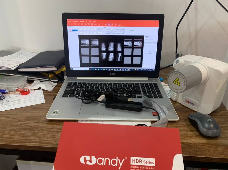 Combo X-quang, senser hãng handy