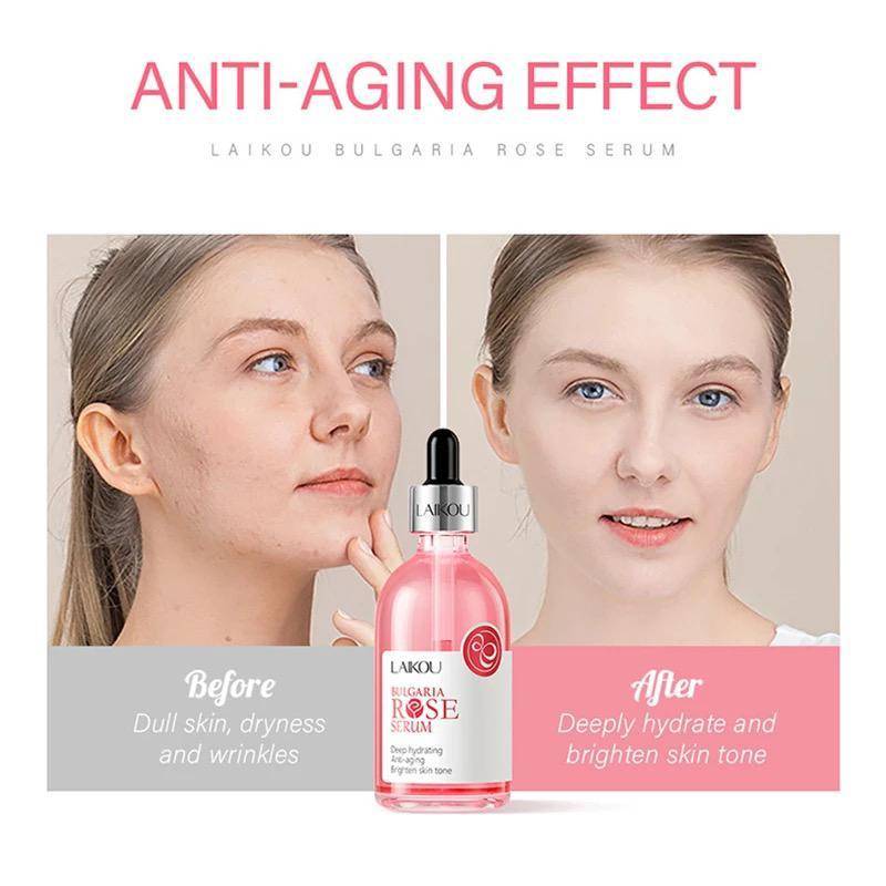Serum de rosas