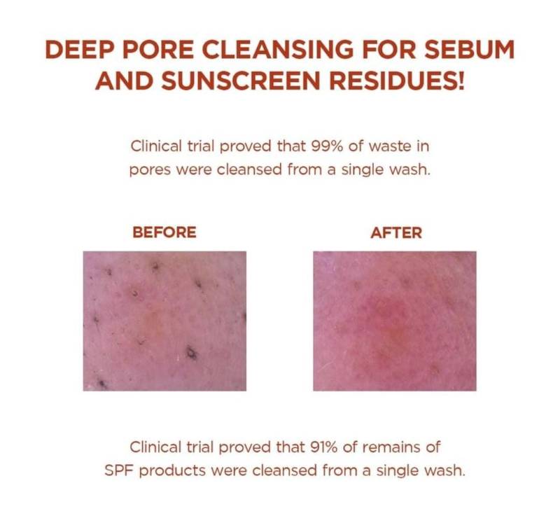 Espuma facial Poremizimg