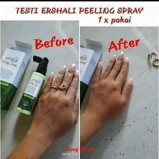 Ershali Peeling Spray