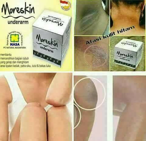 MORESKIN Underarm