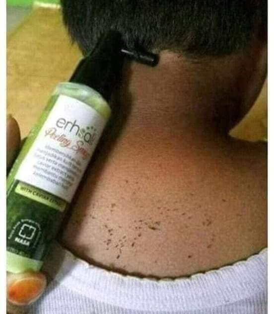 Ershali Peeling Spray