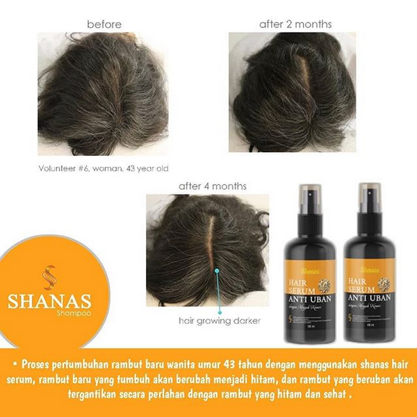 SHANAS Hair Serum Anti Uban