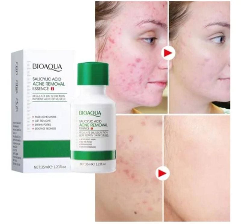 Serum de Ácido Salicílico Acne Removal Essence 35ml